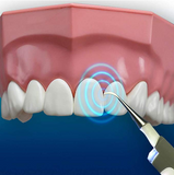 Multi-functional Sonic LED Dental Stain Eraser Tooth Cleaning Whitener