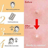 Skin Tag & Acne Patch