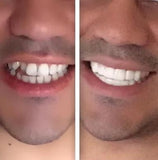 *Limited Supply-THE AMAZING PERFECT SMILE*